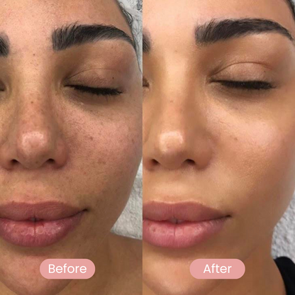 REVEAL™ Dermaplaning Kit