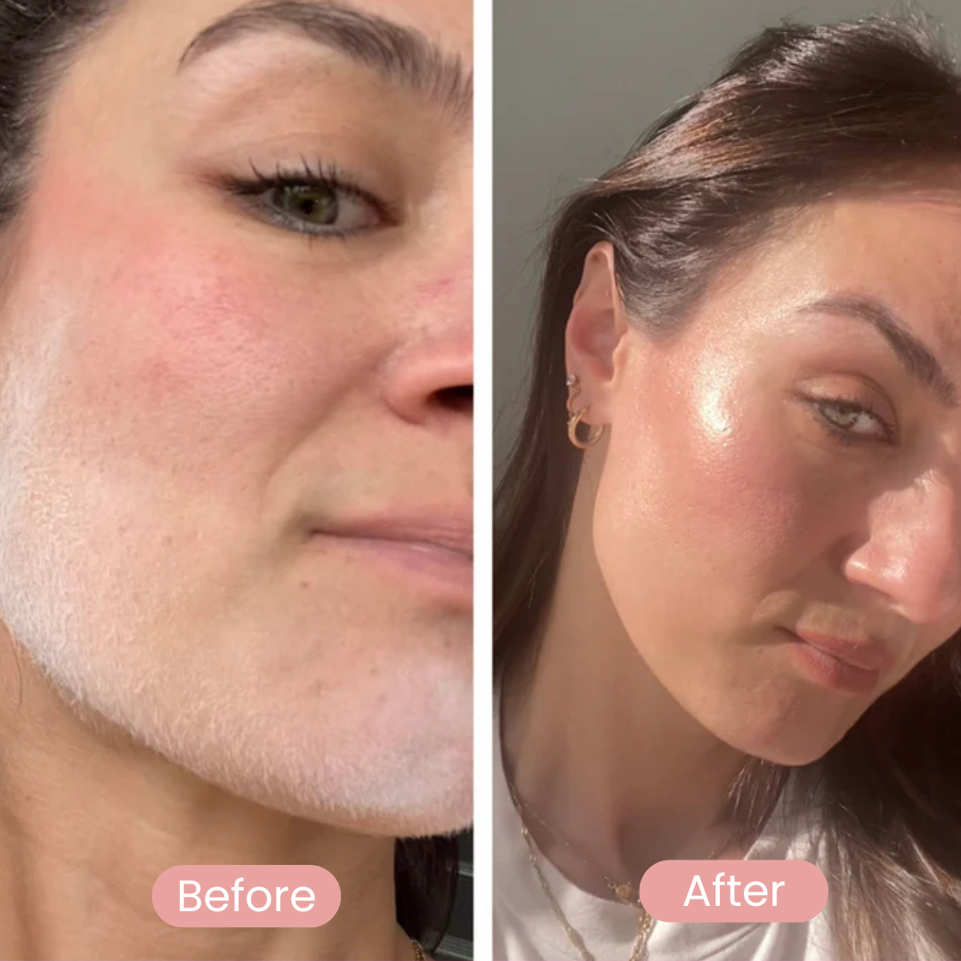 REVEAL™ Dermaplaning Kit
